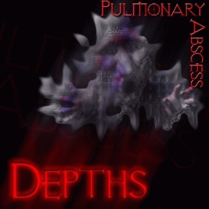 Pulmonary Abscess : Depths